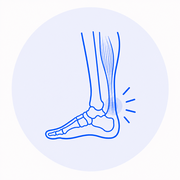 Tendinitis de Aquiles