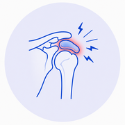 Bursitis