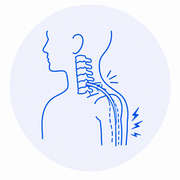 Radiculopatía Cervical