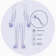 Diabetic Neuropathy