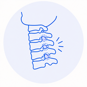 Síndrome de la Articulación Facetaria Cervical