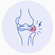 Meniscus Tear