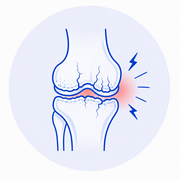 Osteoarthritis