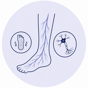 Peripheral Neuropathy