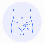 Post-Hernia Repair Pain
