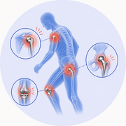 Persistent Pain After Joint Replacement