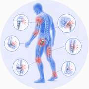 Post-Orthopedic Surgery Pain