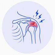 Rotator Cuff Injury