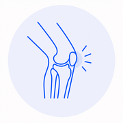Rodilla del Corredor