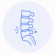 Espondilolistesis
