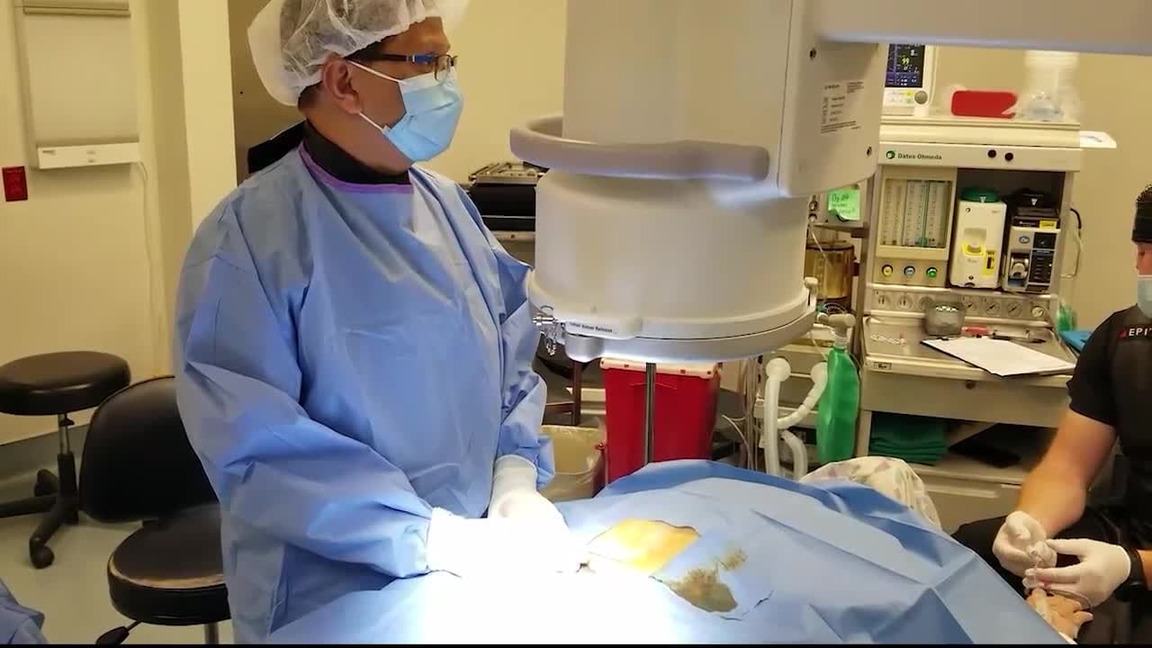 Spinal cord stimulator procedure advanced pain solutions