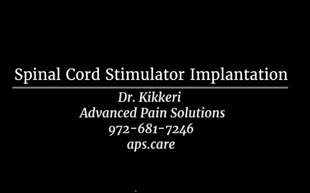 Case Study: Spinal Cord Stimulator Implantation